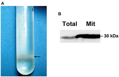 Hypovirus infection induces proliferation and perturbs functions of mitochondria in the chestnut blight fungus